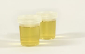 Urine fiole couleur