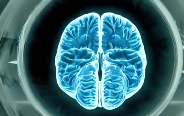 Imagerie d'un cerveau humain